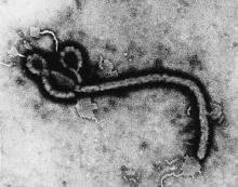 Virus Ebola, ampliado